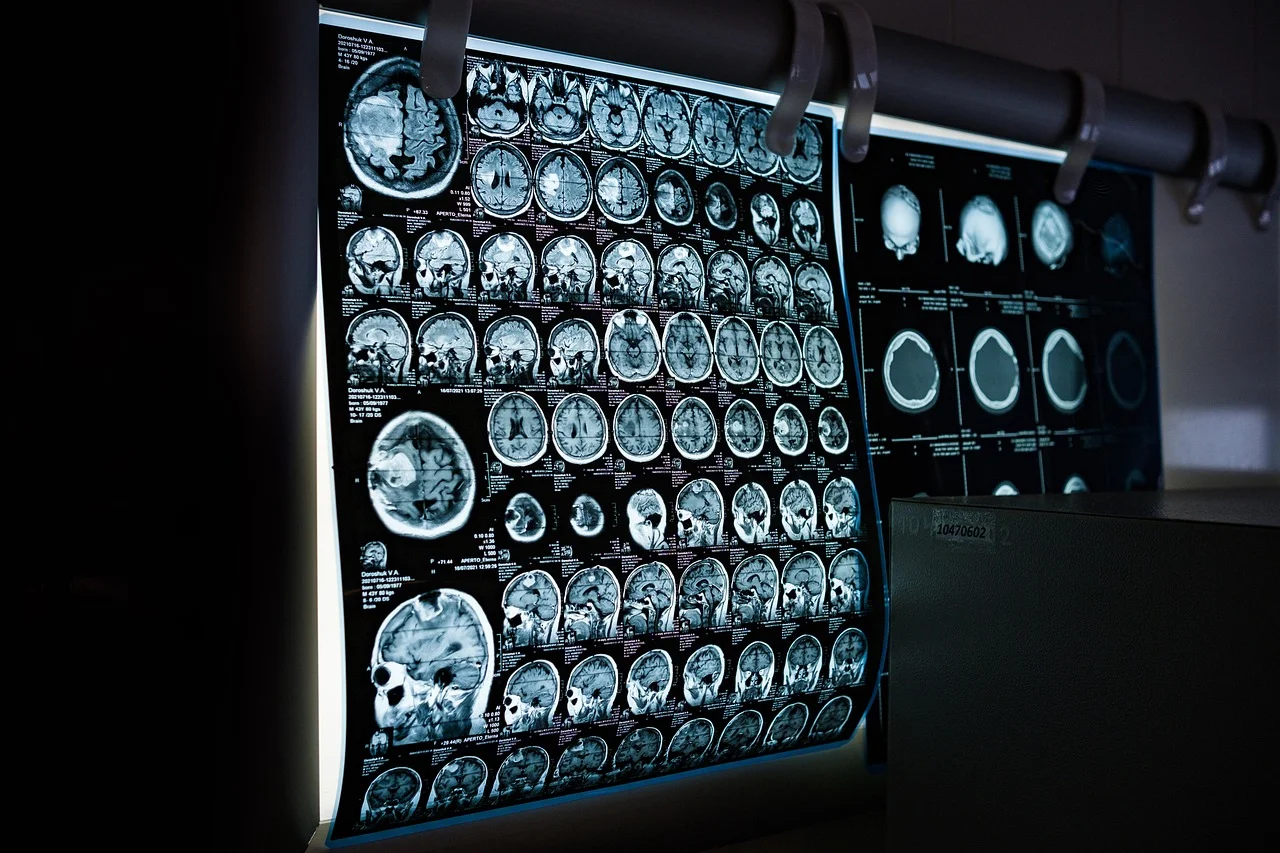 Nowoczesna diagnostyka: jak rezonans magnetyczny zmienia medycynę